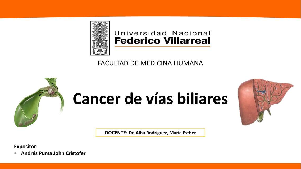 cáncer de las vías biliares