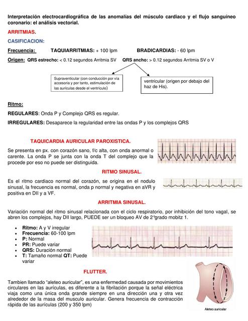 Arritmias bloqueos y fibrilación 