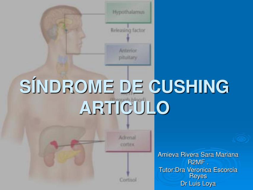 Sindrome de Cushing