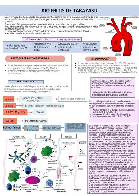 Arteritis de takayasu