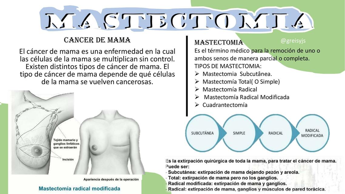 Mastectomia