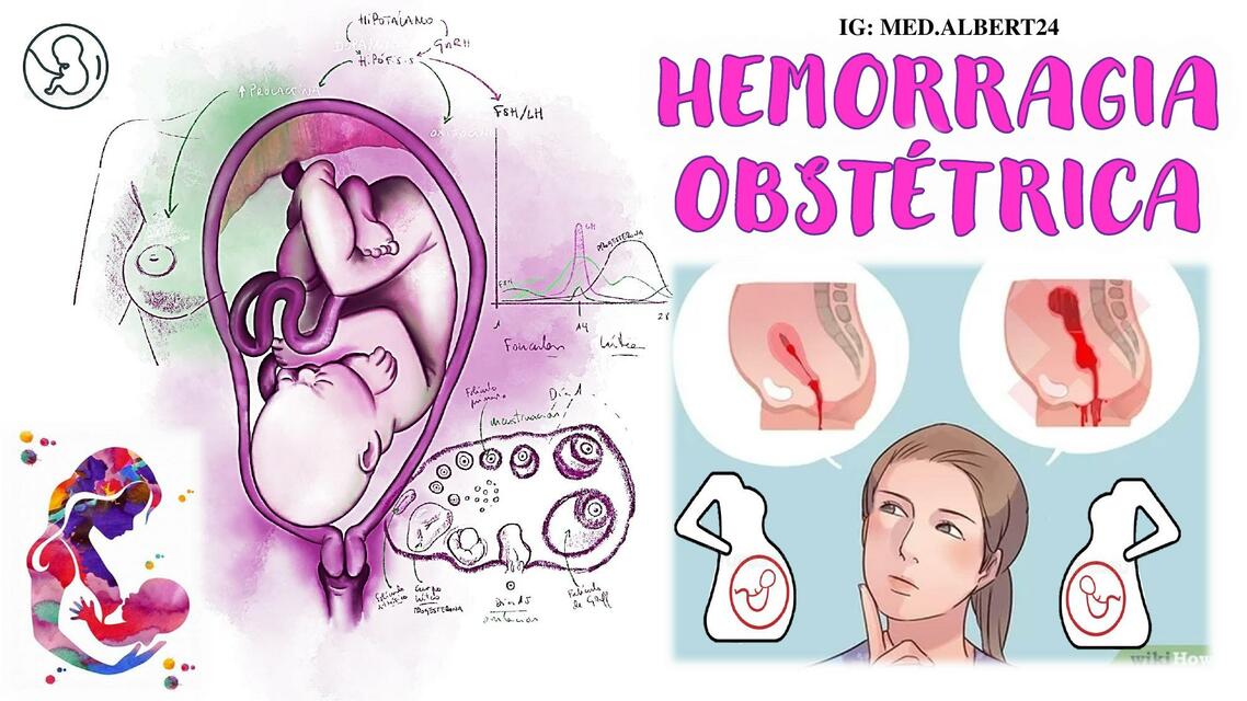 HEMORRAGIA OBSTÉTRICA