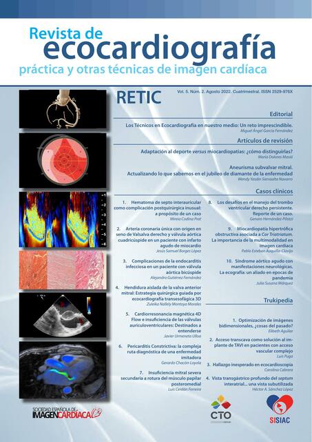 Miocardiopatías