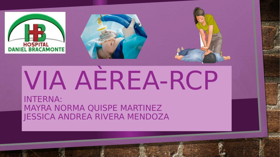 Via aerea y rcp