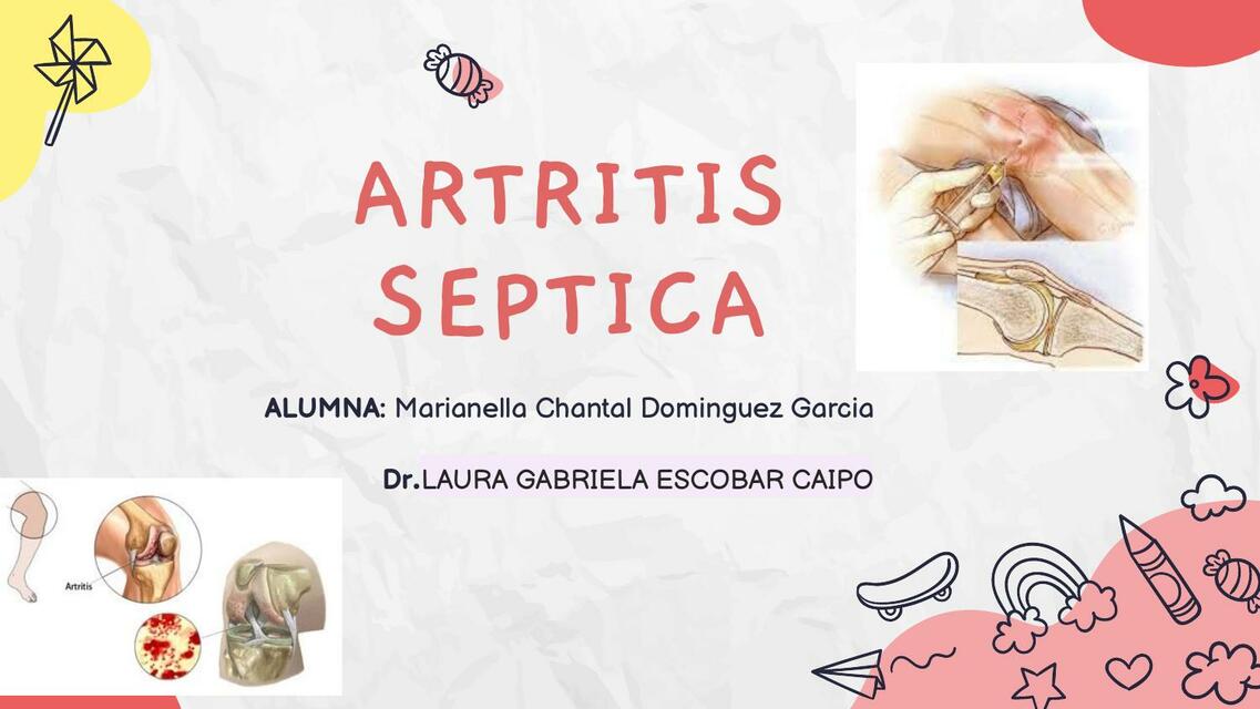 Artritis septica