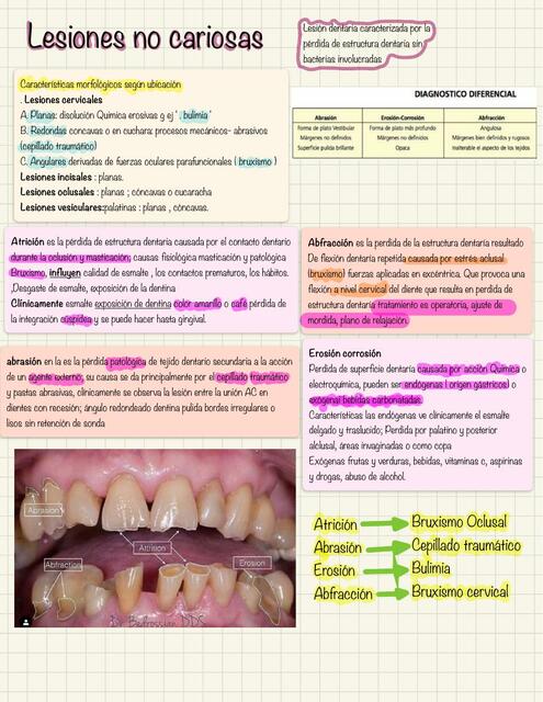 Lesiones No Cariosas