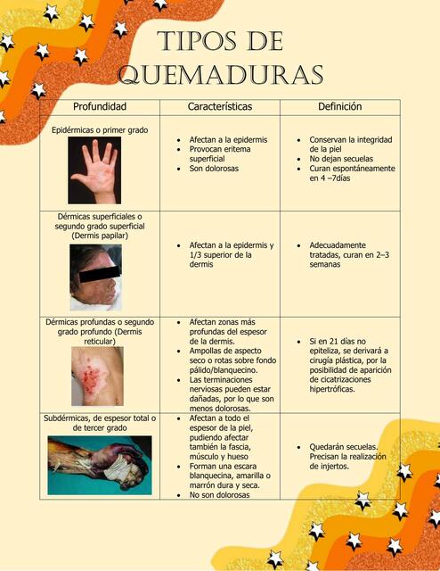 Tipos de Quemaduras 