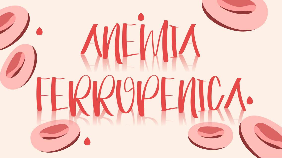 Anemia Ferropénica 