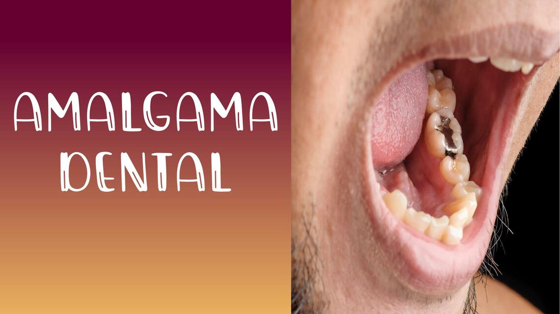 Amalgama Dental Dentinotes_av uDocz