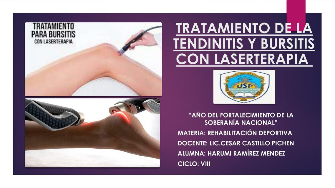 Laserterapia 