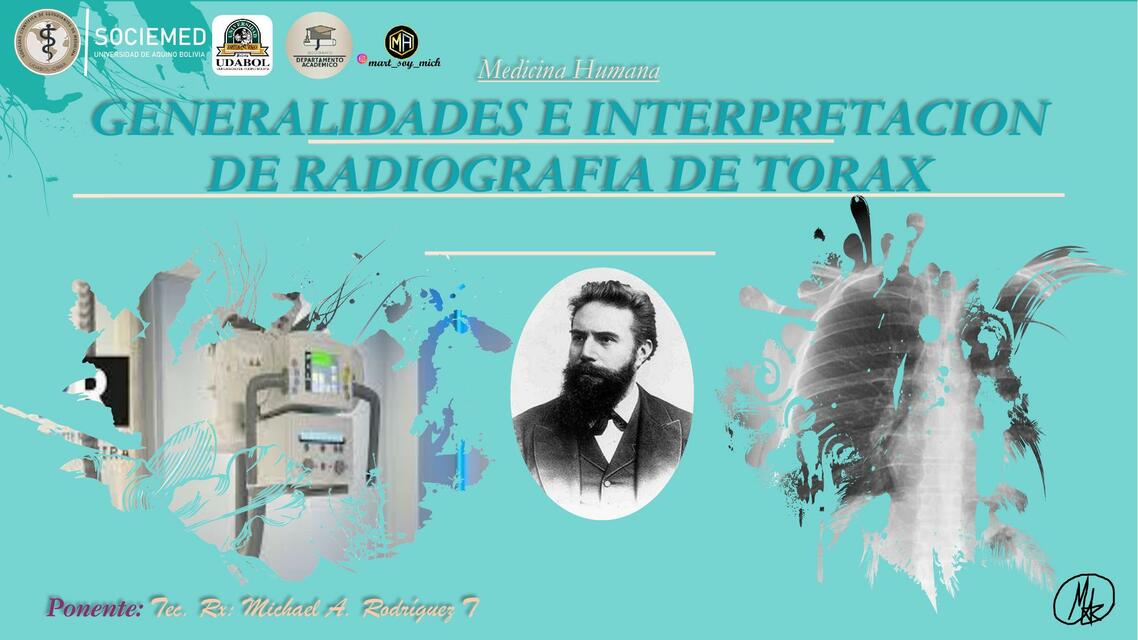 GENERALIDADES E INTERPRETACION DE RADIOGRAFIA DE TORAX