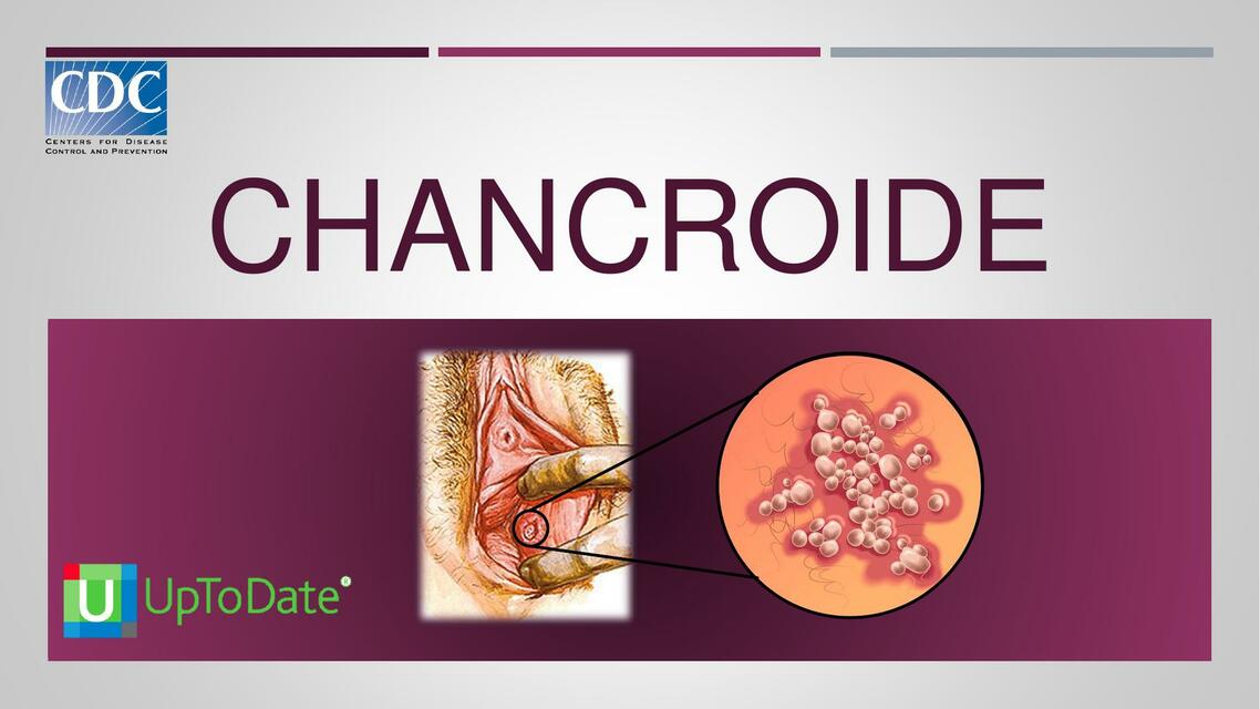 Chancroide