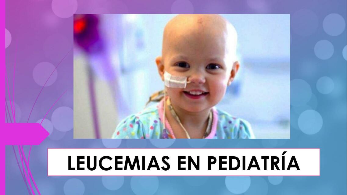 LEUCEMIAS EN PEDIATRÍA FINAL