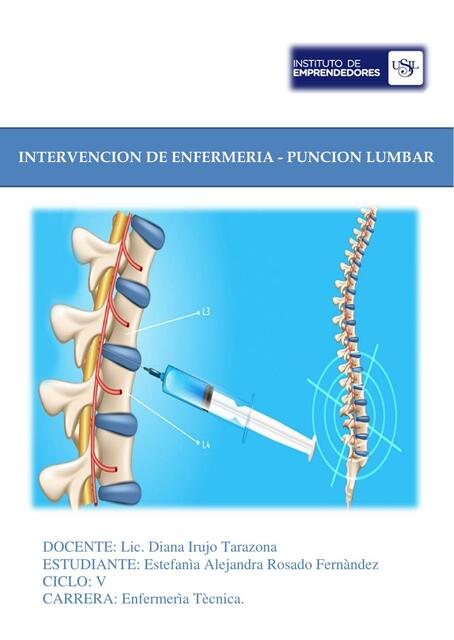 Puncin Lumbar 