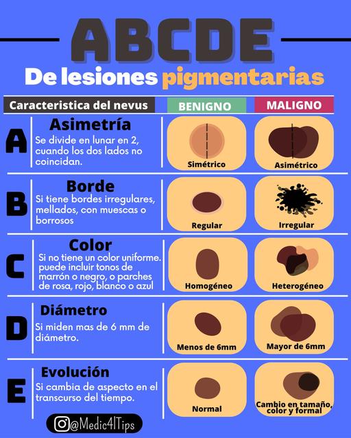 ABCDE de Lesiones Pigmentarias