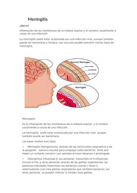 Meningitis