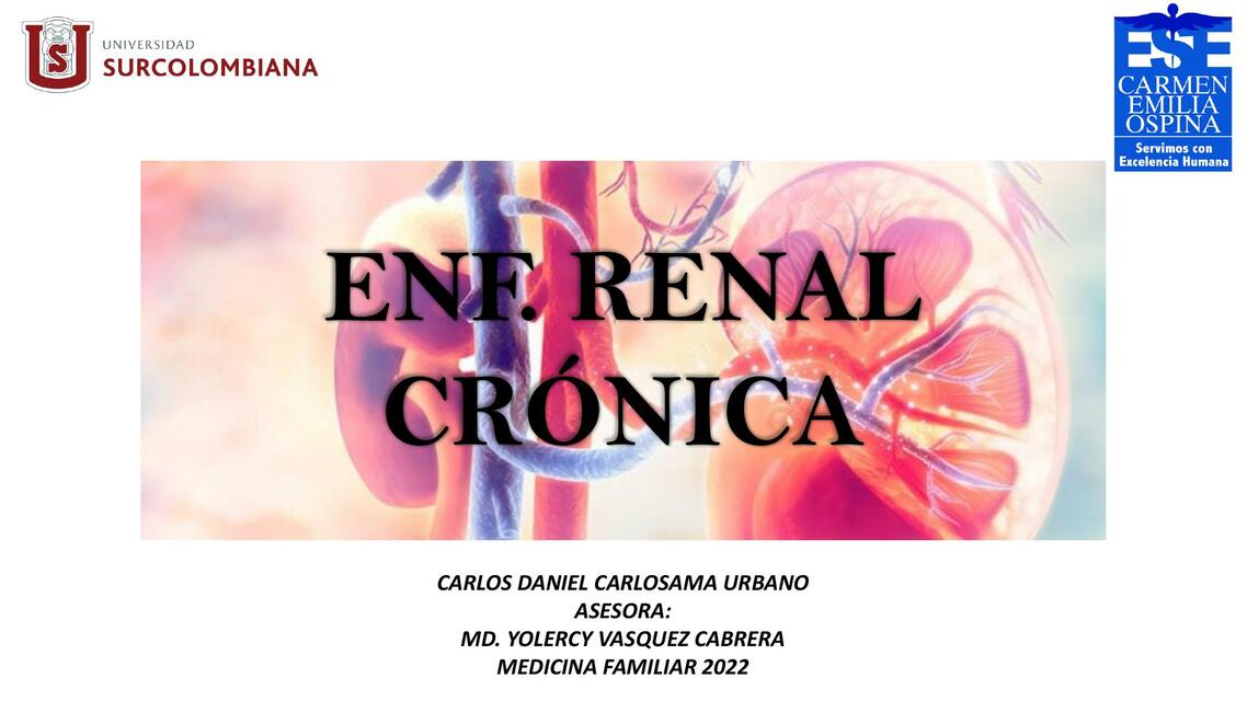 Enfermedad renal crónica