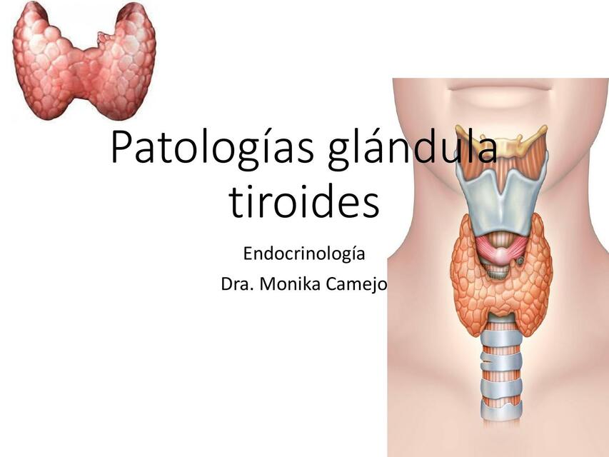 Hiper Hipotiroidismo tiroiditis 3 1