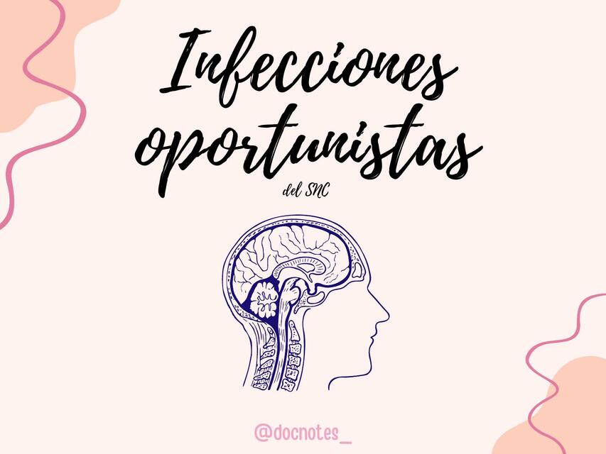Infecciones Oportunistas del SNC Ashley uDocz
