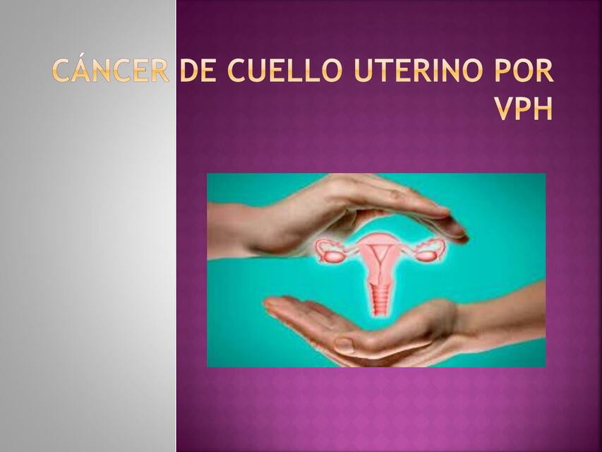 Cáncer de Cuello Uterino por VPH