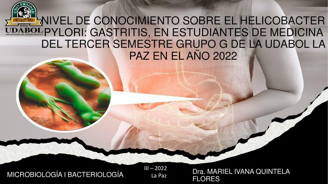 Nivel del Conocimiento sobre el Helicobacter Pylori: Gastritis, en Estudiantes de Medicina 