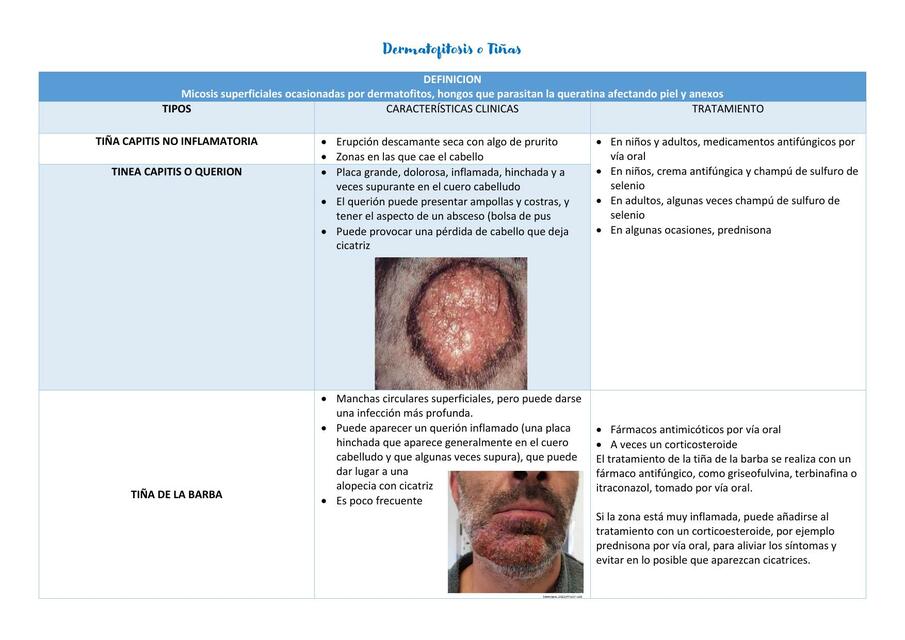 Flashcards De Dermatofitosis O Ti as Por Angie Ortiz UDocz Flashcards De Dermatofitosis O Ti as Por Angie Ortiz UDocz