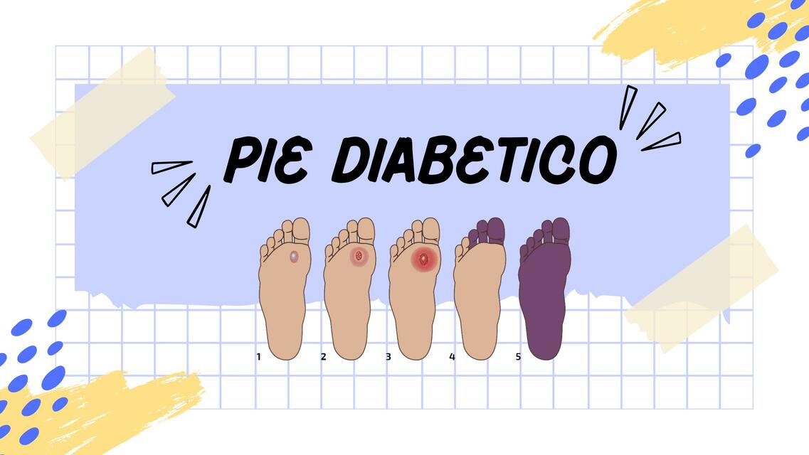 Pie diabético Mariangel Ch uDocz