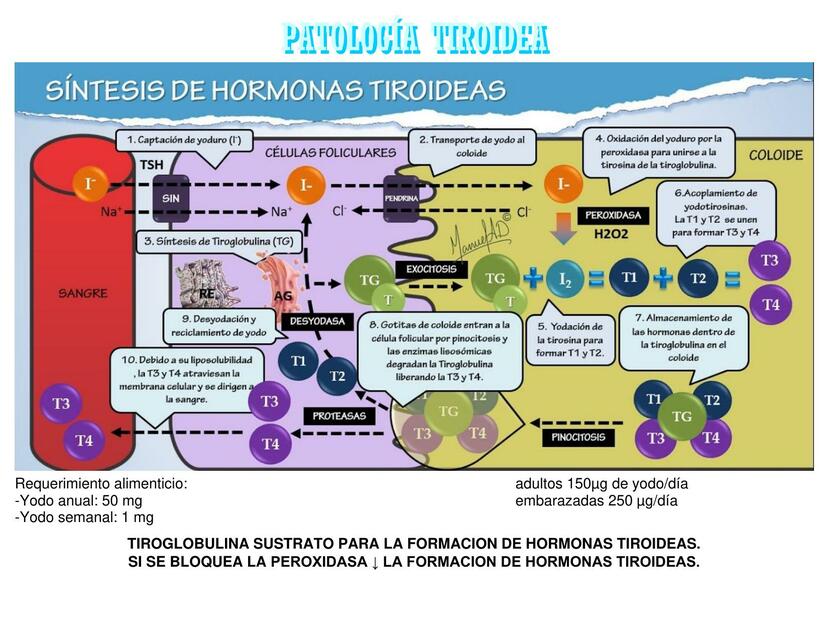 Patología  Tiroidea 