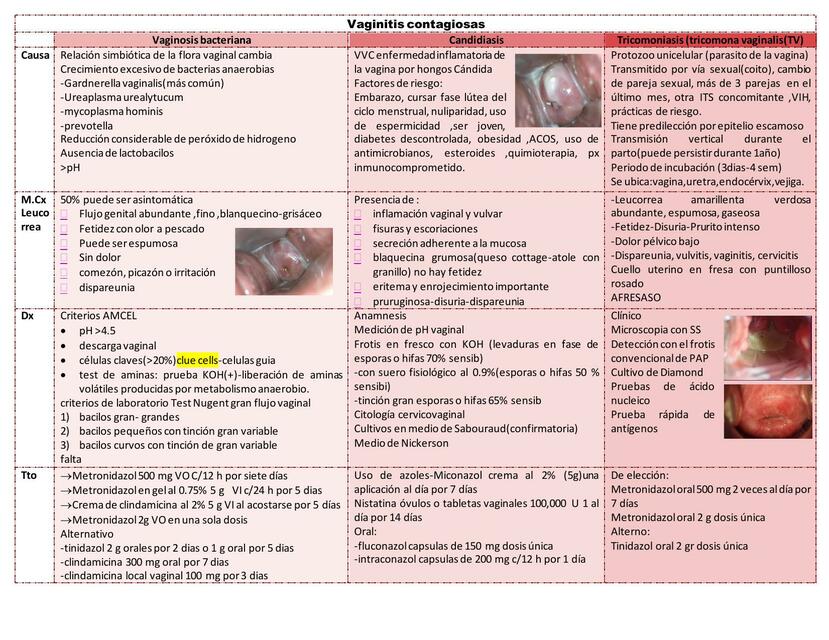 Infecciones Vaginales