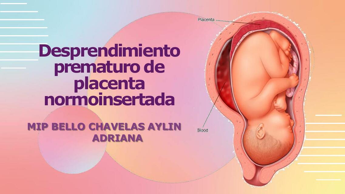 Desprendimiento prematuro de placenta normoinsertada