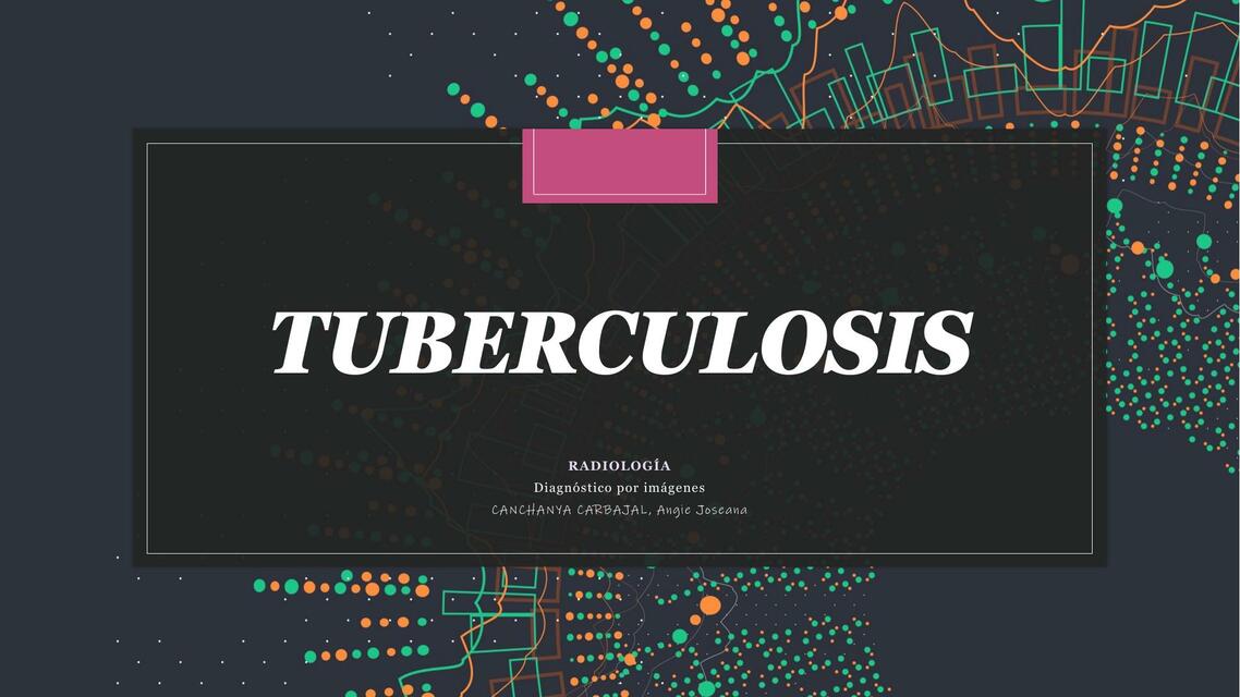 Tuberculosis