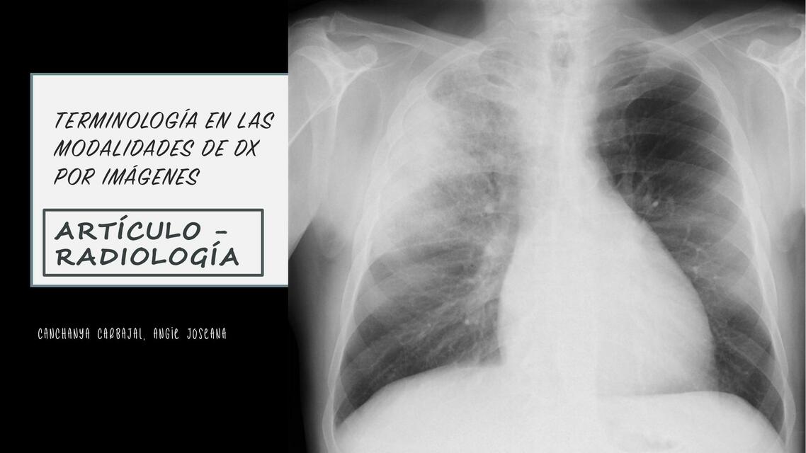 Terminología en las modalidades de dx por imágenes