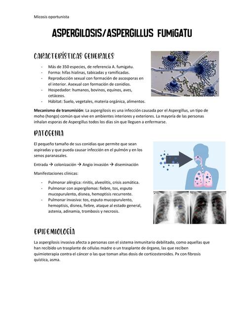 Aspergilosis causada por Aspergillus spp