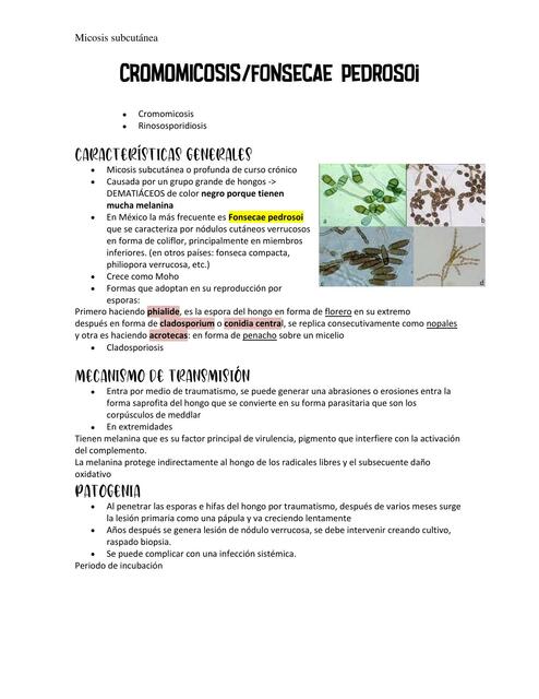 Cromoblastomicosis causada por fonsecae pedrosoi.