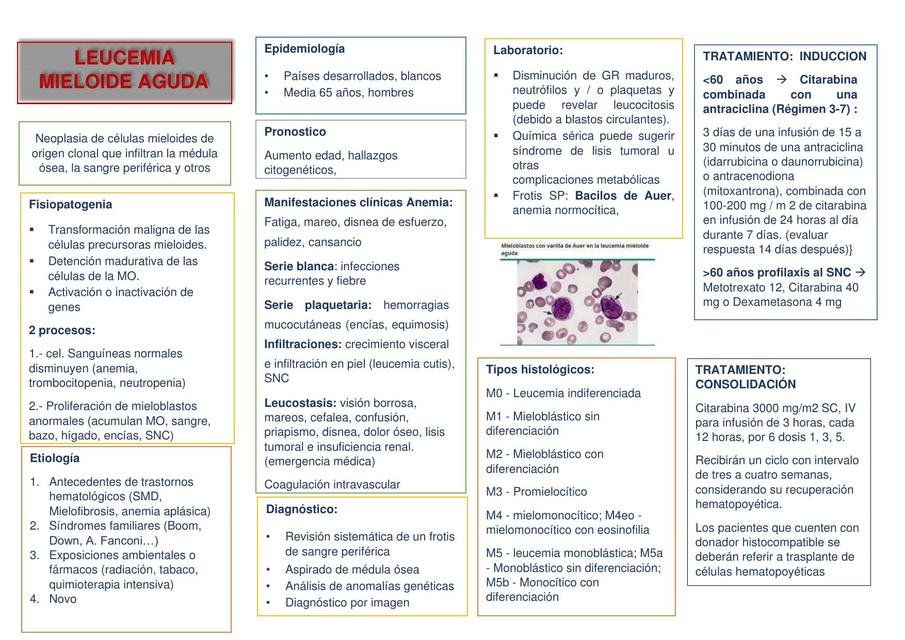 Leucemia mieloide aguda