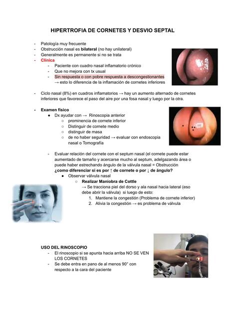 Hipertrofia de cornetes y desvío septal | MEDilove | uDocz
