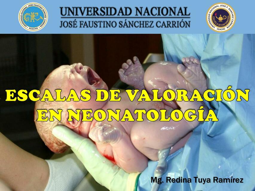 Escalas de valoración en neonatologia 