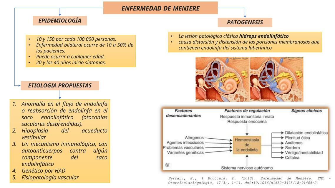 Resúmenes de Enfermedad de Meniere | Descarga apuntes de Enfermedad de