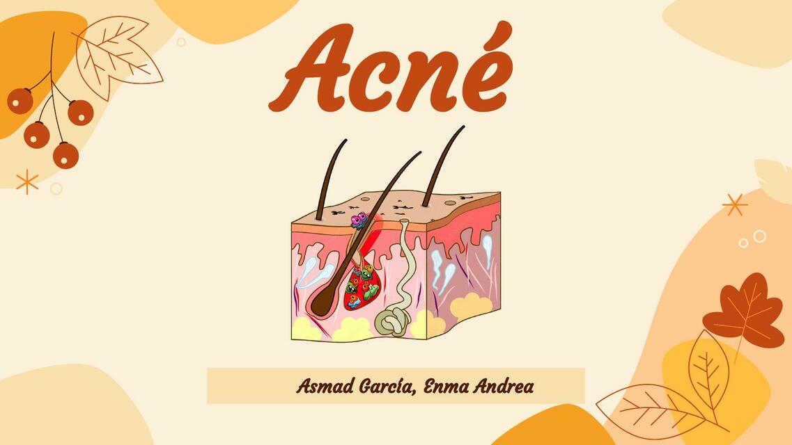 Acné 