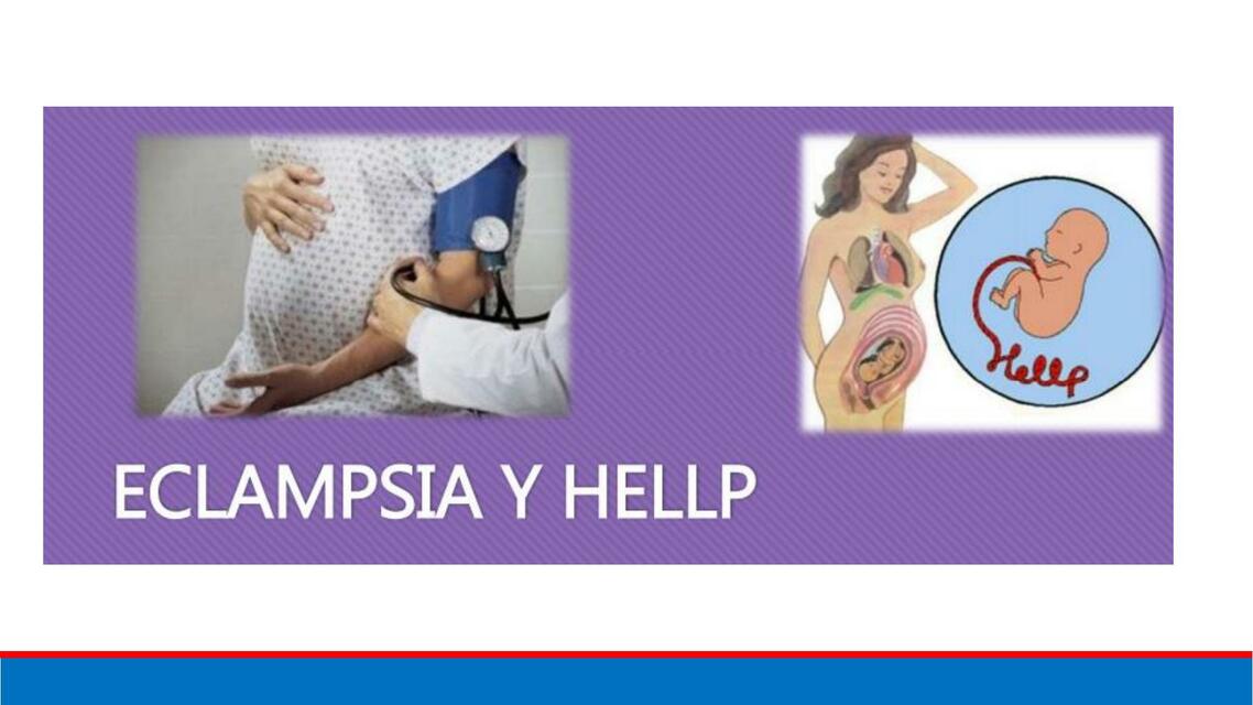 Eclampsia y Hellp 