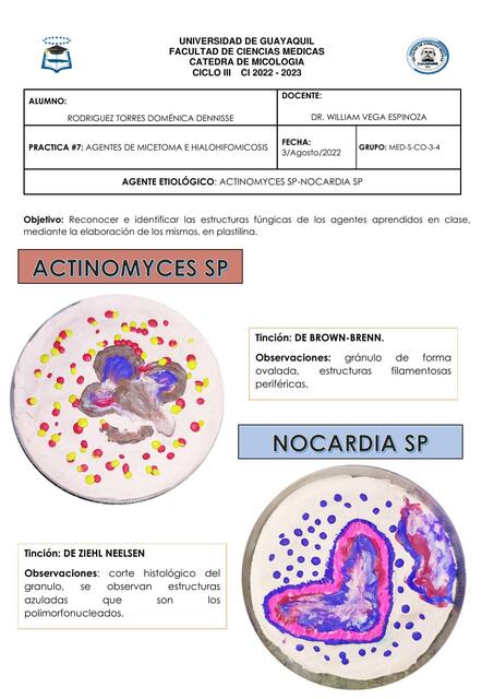 Micetoma e hialohfomicosis