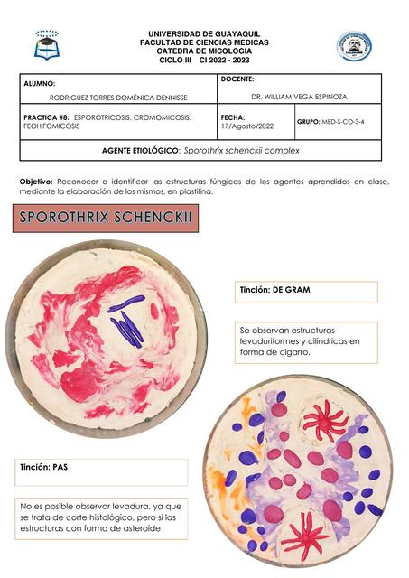 Esporotricosis