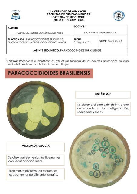 Paracoccidioides