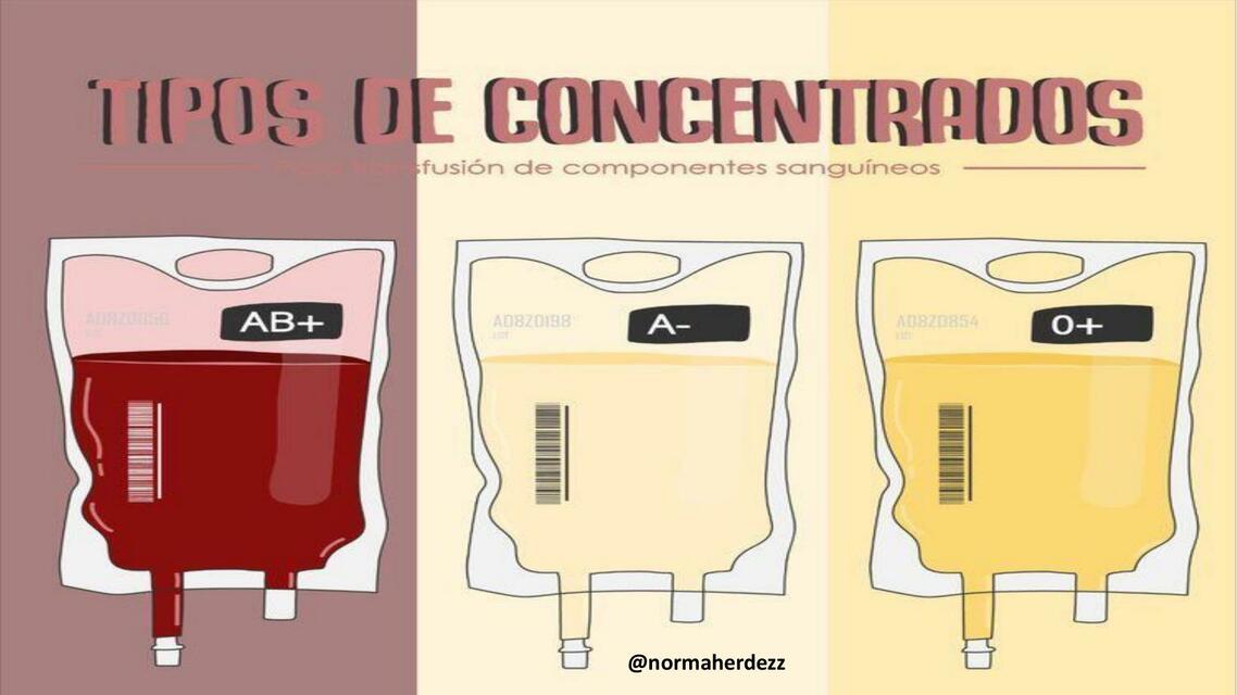 Tipos De Concentrados