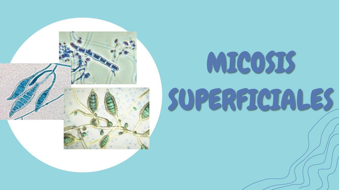 Micosis superficiales