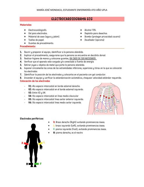 Electrocardiograma ECG