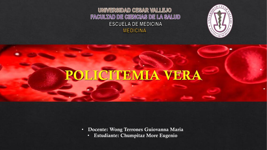 Hematología - Policitemia vera