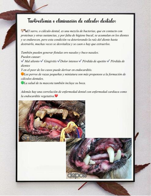 Tartrectomía o eliminación de cálculos dentales fraii uDocz