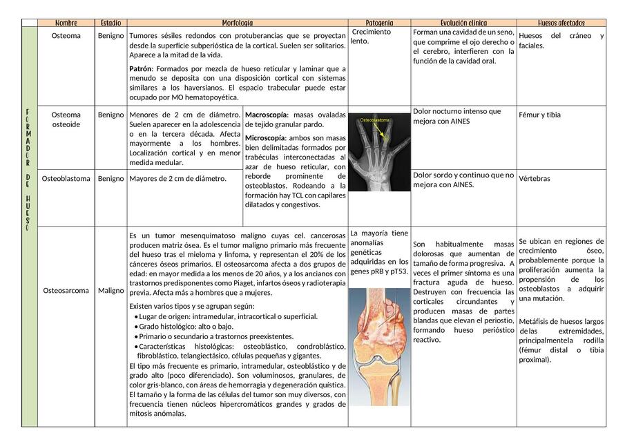 Tumores Óseos