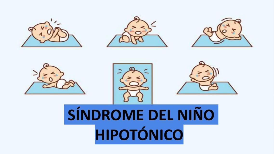 Síndrome del Niño Hipotónico | samxnthastudy | uDocz